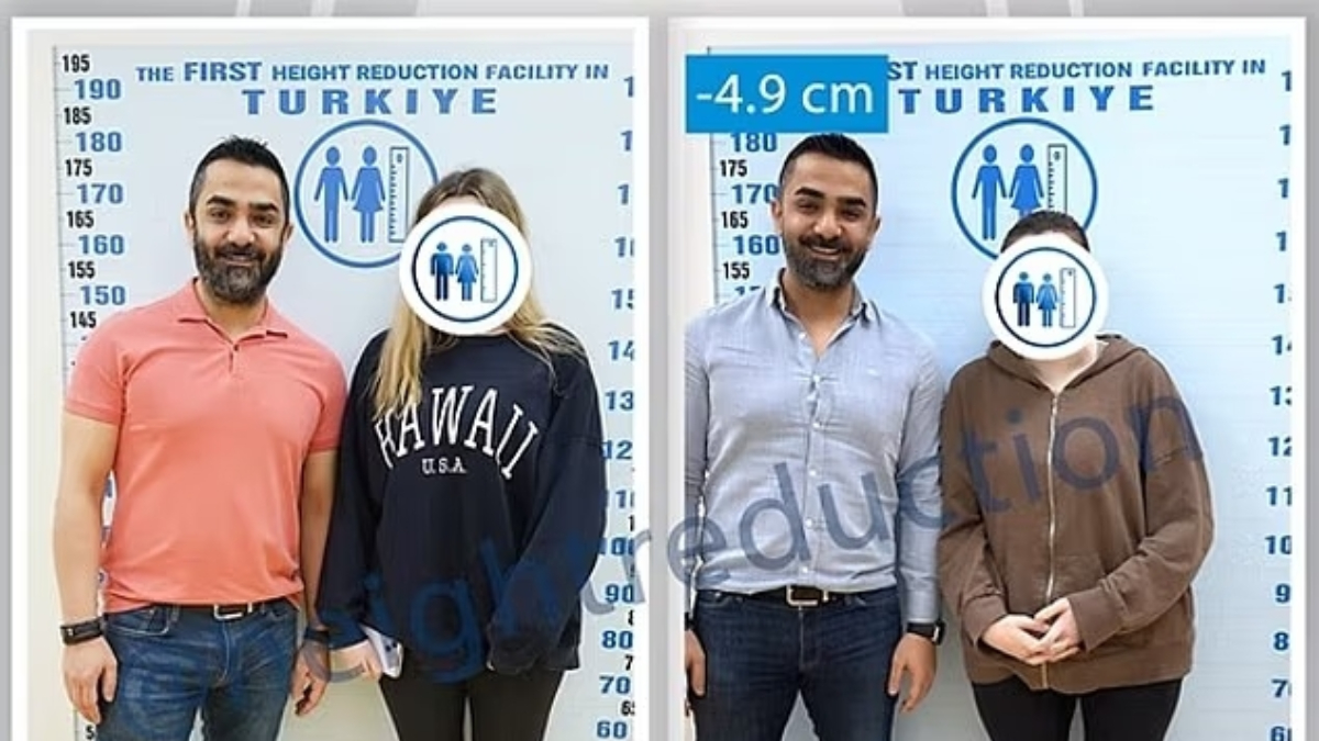Yabancılardan bir garip trend: Boy kısaltma için Türkiye'ye geliyorlar