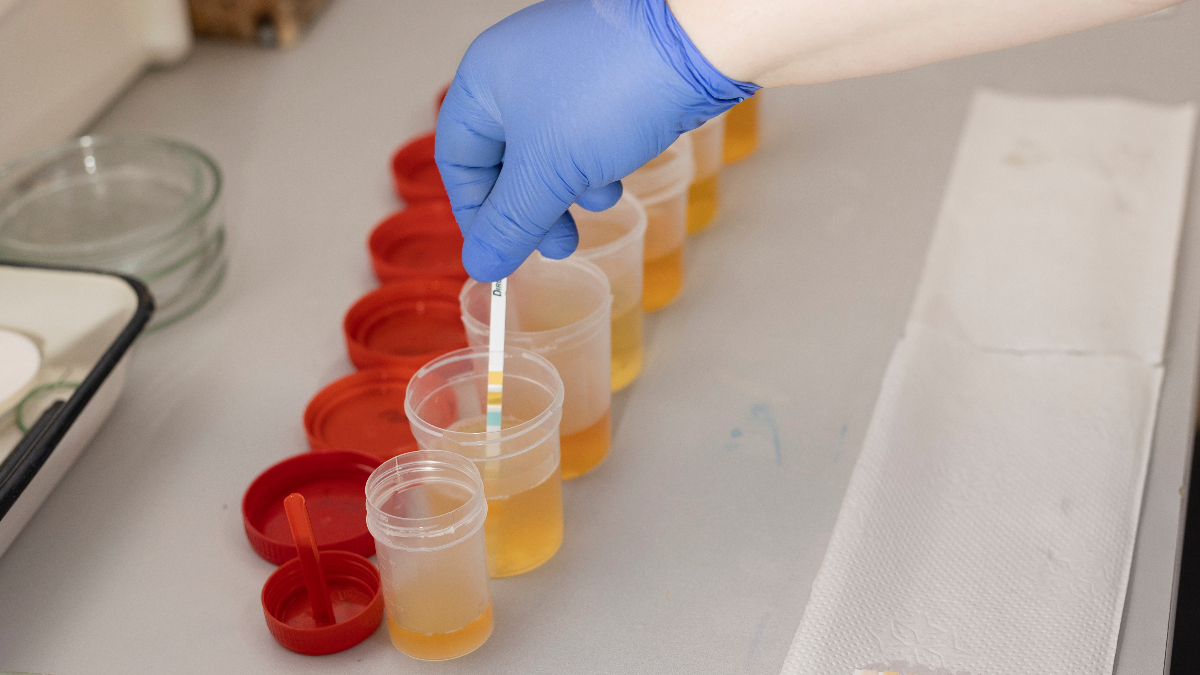 İdrarda bu detaya dikkat: Sağlıkla ilgili mesaj veriyor