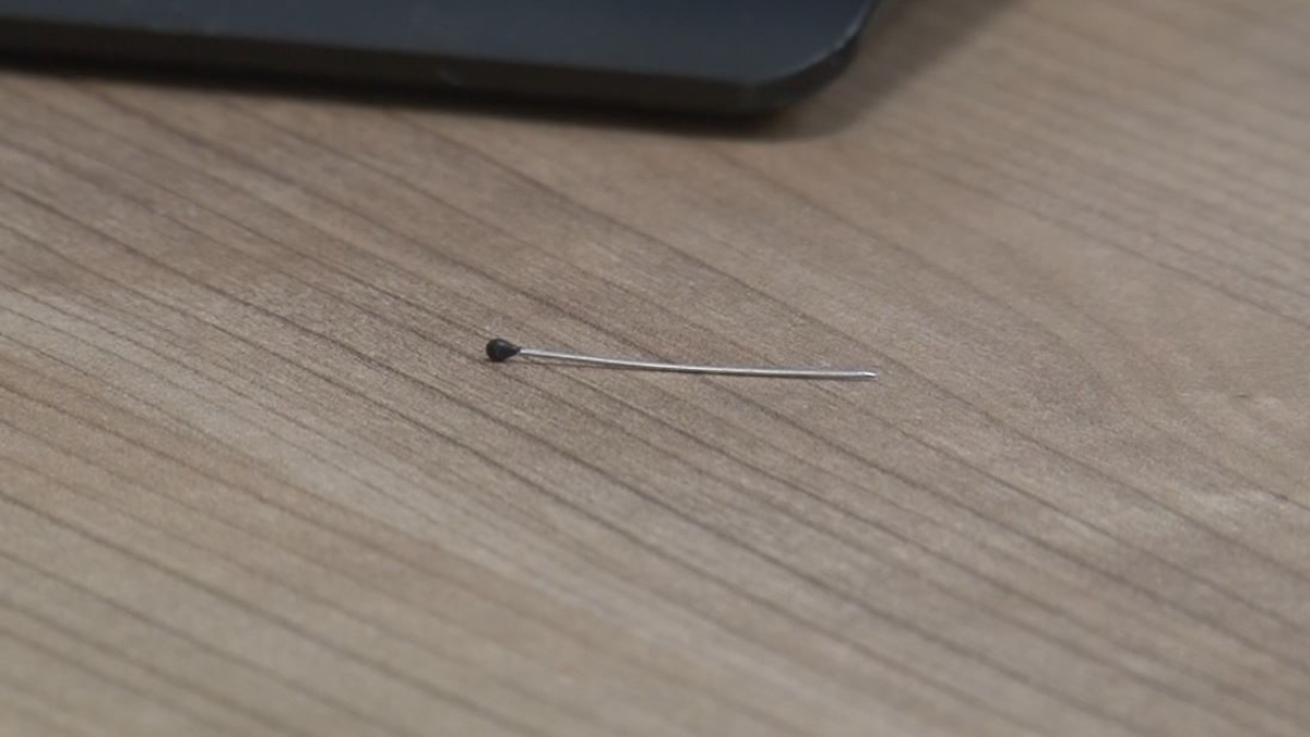 İstanbul'da 2 yaşındandaki bebeğin bağırsağından iğne çıktı