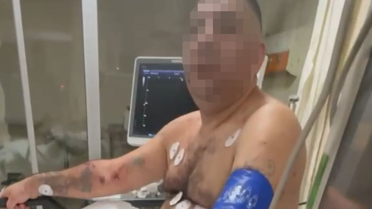 İstanbul'da pompalı tüfekle çevreye ateş etti