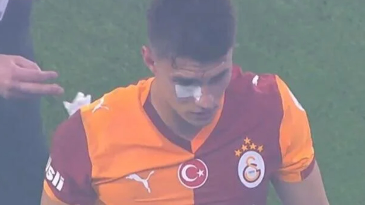 Kazımcan Karataş'a derbide yabancı madde geldi!