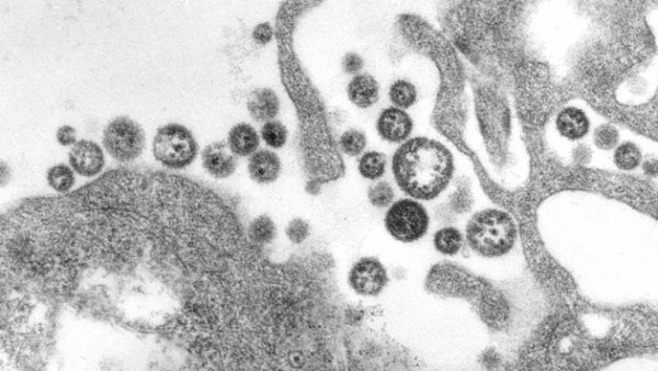 Ölümcül Lassa Humması'na aşı bulunamıyor