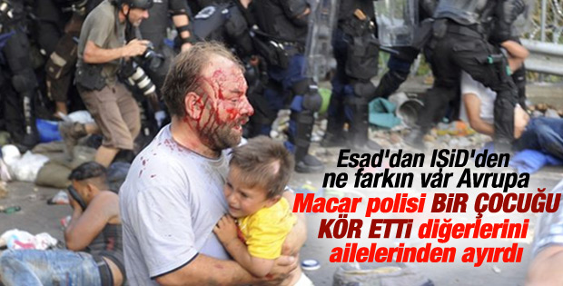 Macar polisi mülteci çocuğu kör etti