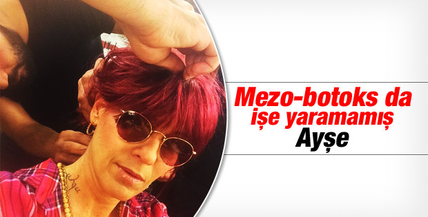 Ayşe Arman mezo-botoks yaptırdı