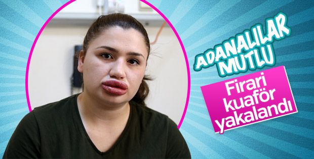 Cezaevinden kaçan sahte estetikçi yakalandı