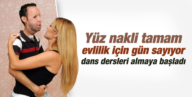 Yüz nakli yapılan Recep Sert’i evlilik heyecanı sardı