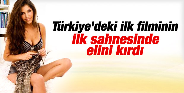 Yolanthe Cabau film çekiminde elini kırdı