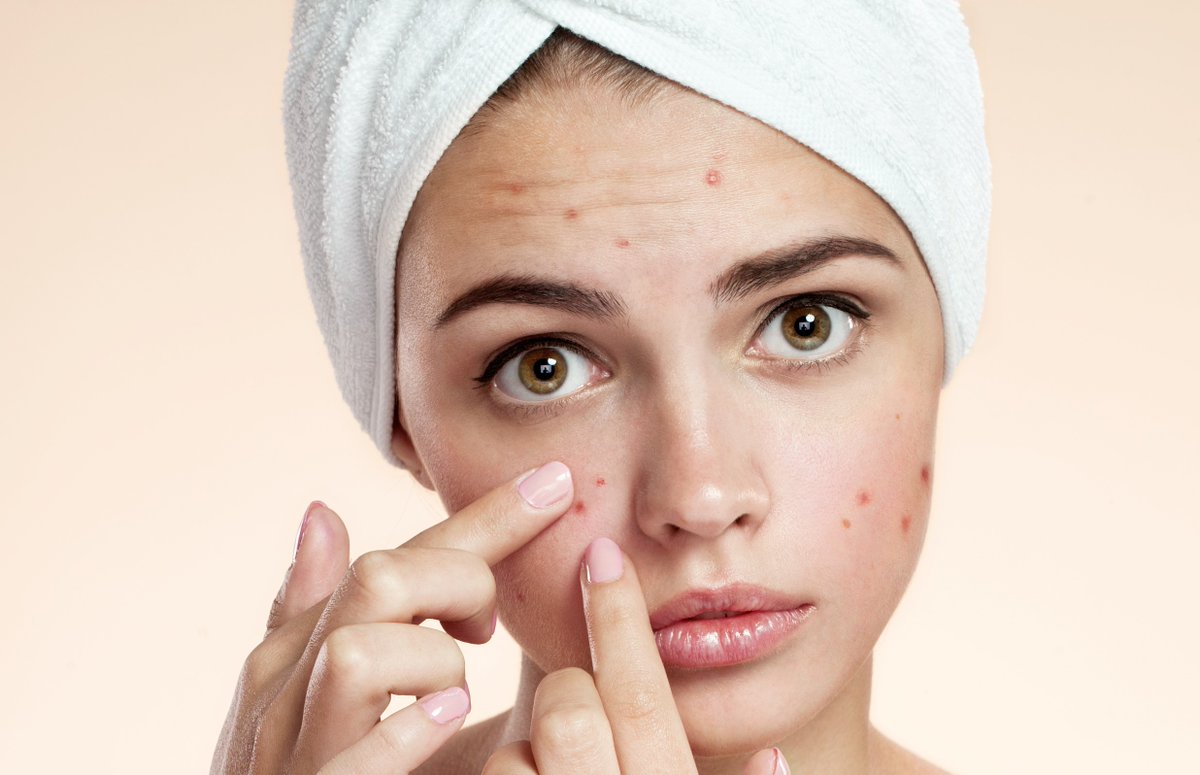 Do not neglect skin problems during the epidemic #1