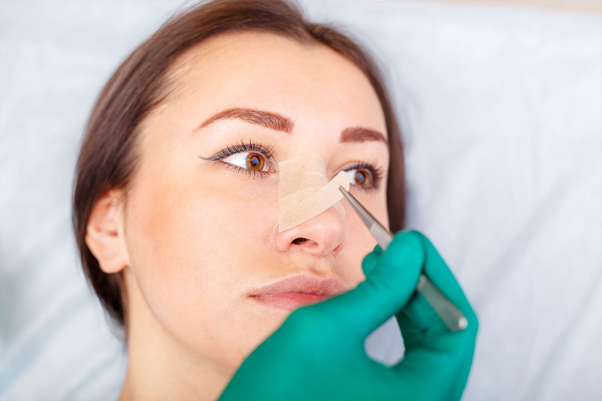 Things to consider after nose surgery #1