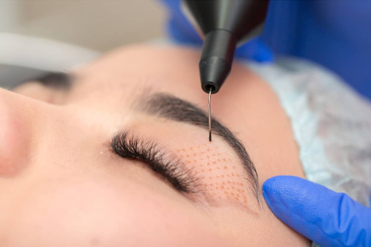 No need to go under the knife for wrinkle treatment #1