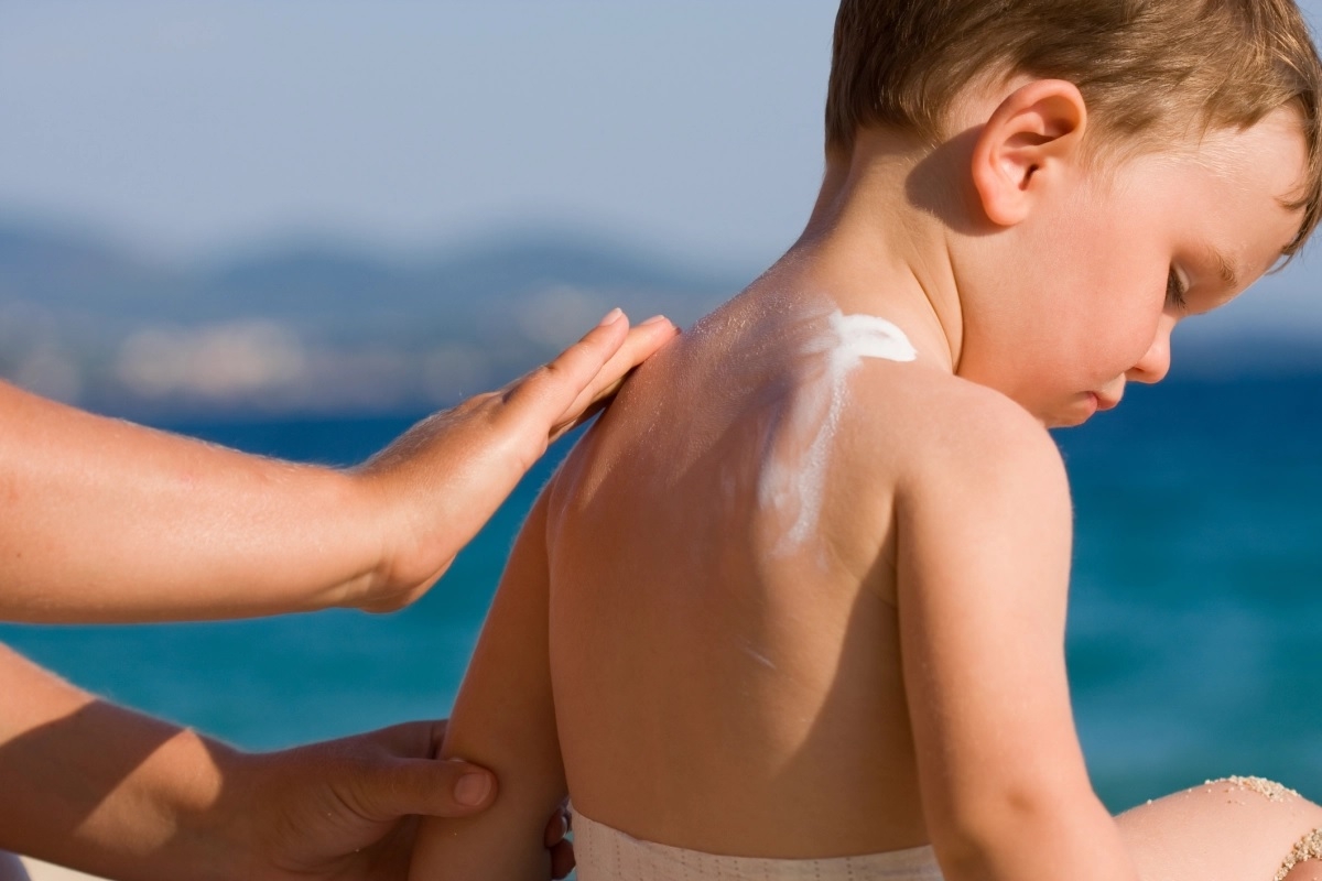Childhood sunburn increases cancer risk #2