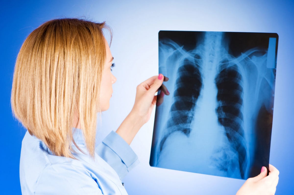 Akciğer embolisi ani ölümlere neden olabilir #2