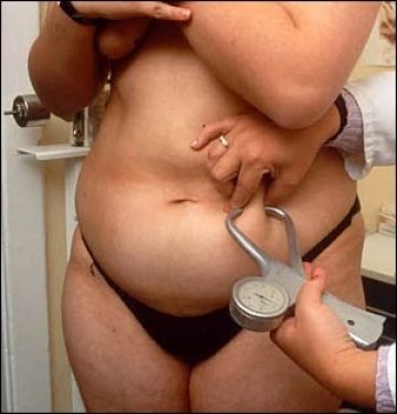 Beden kitle endeksinin en fazla ve en az olduğu bazı ülkeler