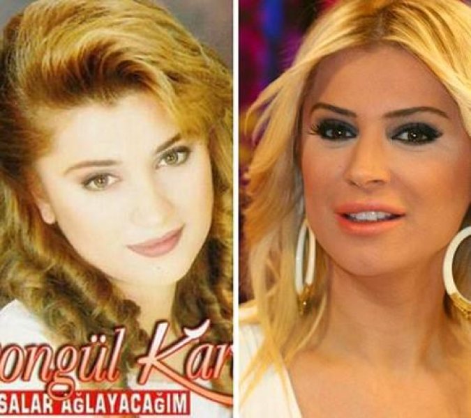 Estetik harikası ünlüler