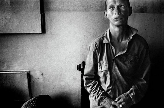 Savaşın insanlar üzerindeki korkunç etkisi