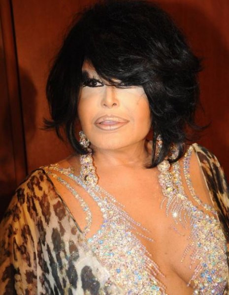 Bülent Ersoy gece yarısı dişçiye gitti