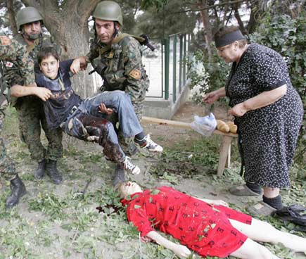 Savaşın vahşi yüzünden kareler