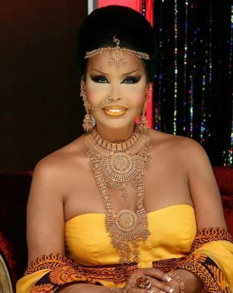 Bülent Ersoy gece yarısı dişçiye gitti