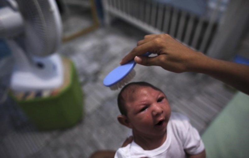 Zika virüsünün mahvettiği bebekler