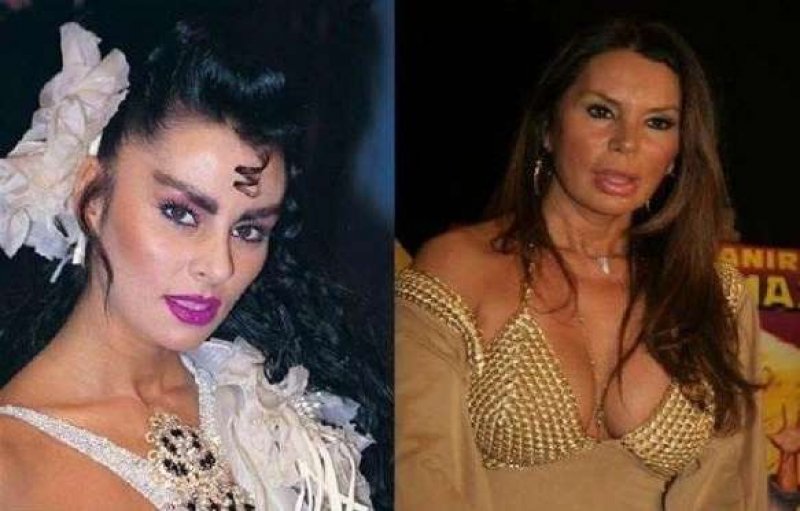 Yeşilçam ünlülerinin önceki ve şimdiki halleri