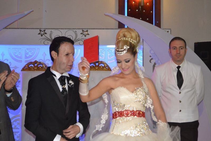 Yüz nakli olan Recep Sert dünyaevine girdi