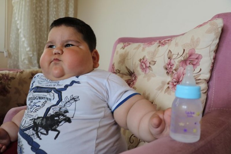 Yağız bebek leptin hormonu eksikliği sonucu 32 kilo oldu