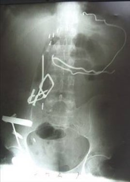 Dünyanın en ilginç olayları