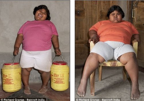 6 yaşında 92 kilo