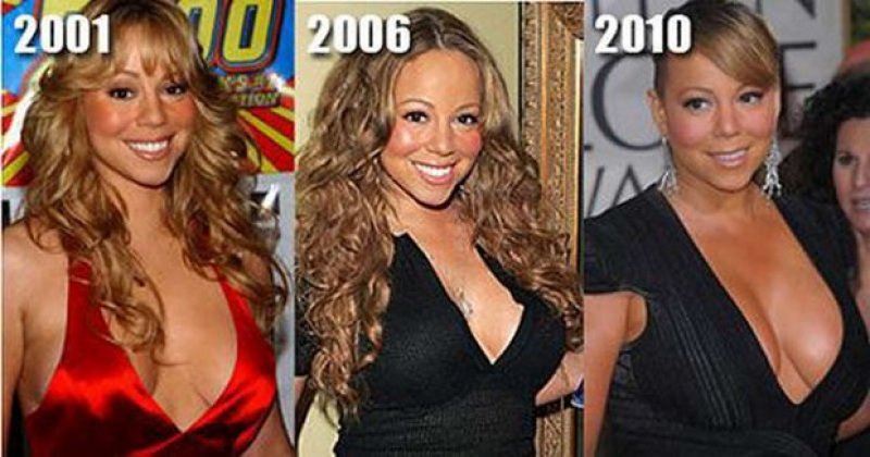 12/33. ABD'li şarkıcı Mariah Carey küçük operasyon yaptıranlardan. 