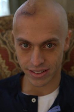 Medcezir'in Orkun'u Metin Akdülger tanınmaz halde