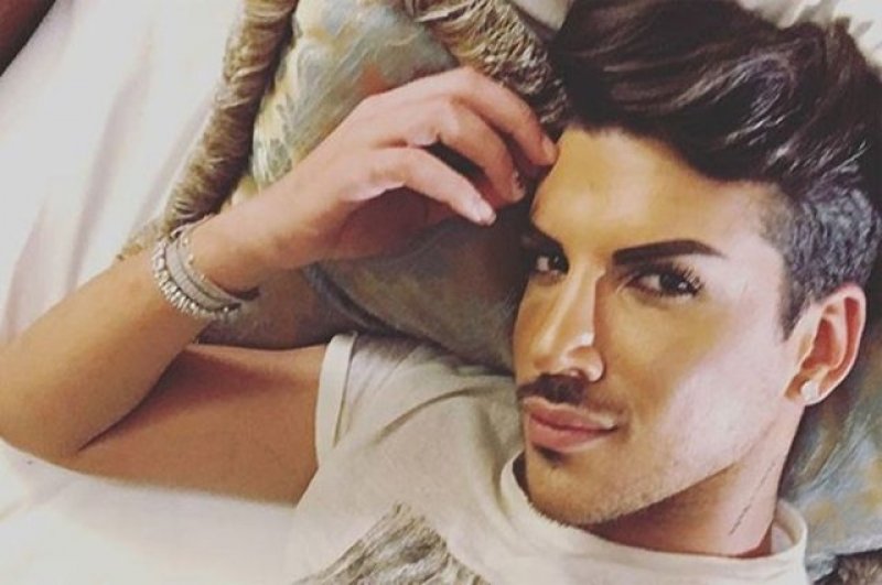 Kerimcan Durmaz'ın estetiksiz hali