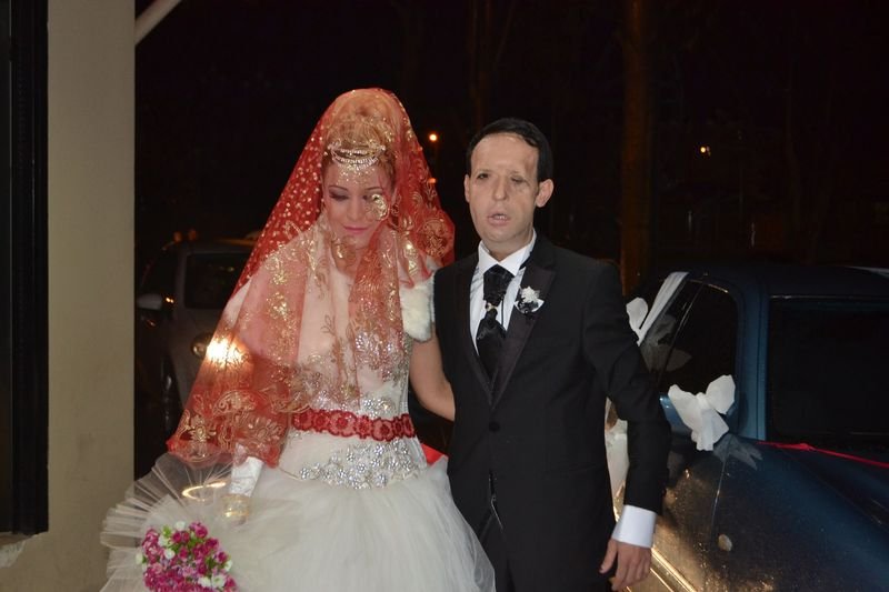 Yüz nakli olan Recep Sert dünyaevine girdi