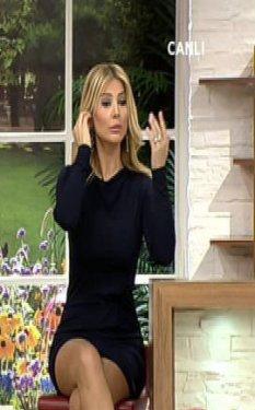 Songül Karlı'nın silikonlu dudakları kapanmıyor