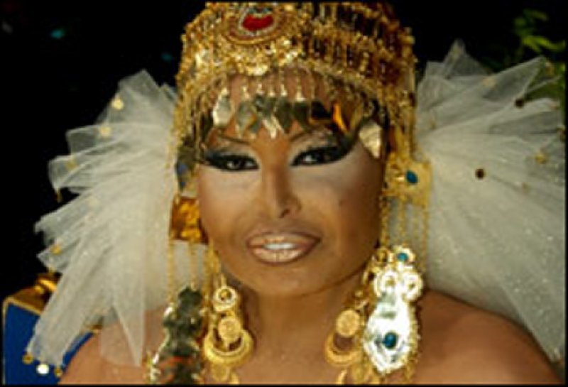 Bülent Ersoy bir haftadır tedavi görüyor 