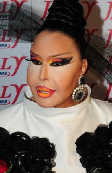 Bülent Ersoy bir haftadır tedavi görüyor 