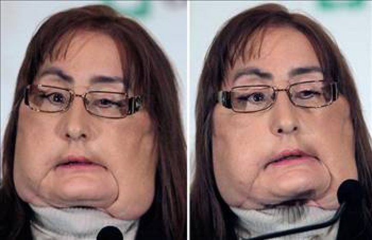 En ilginç tıbbi vakalar