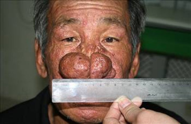 En ilginç tıbbi vakalar