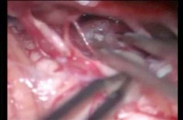 En ilginç tıbbi vakalar