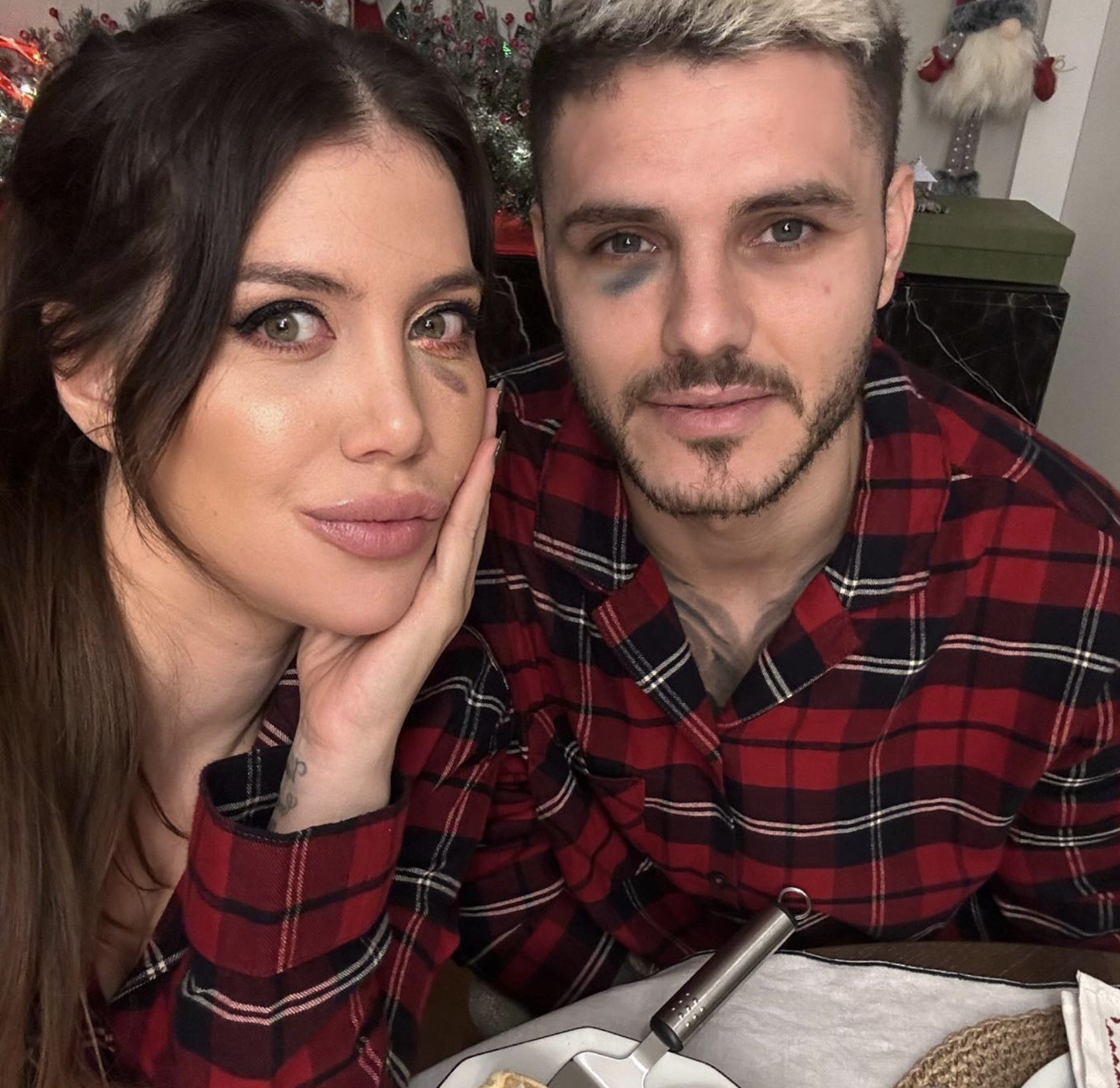 Wanda Nara, Mauro Icardi'yi sosyal medyada takipten çıktı