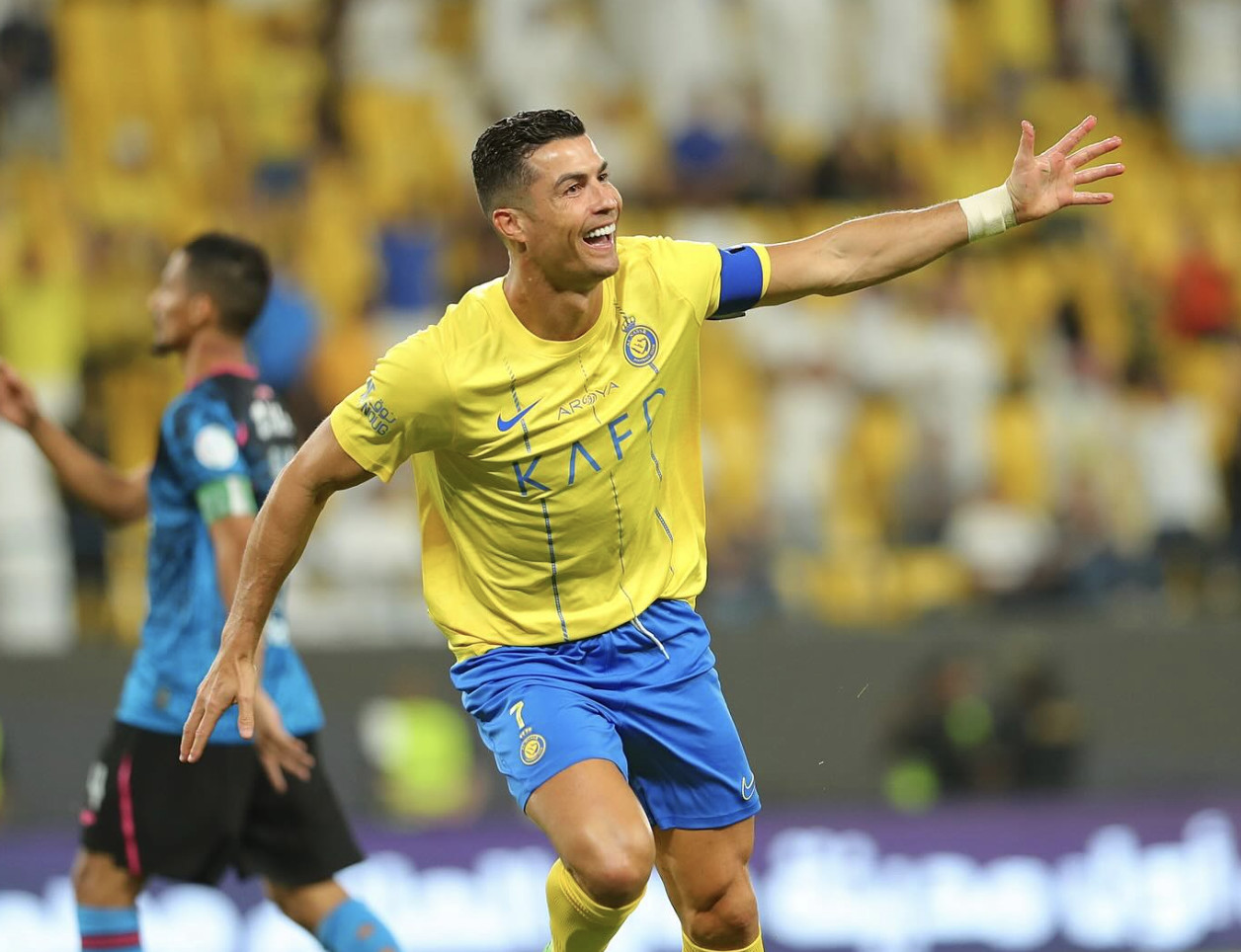 Vücudunu sigortalatan ünlüler