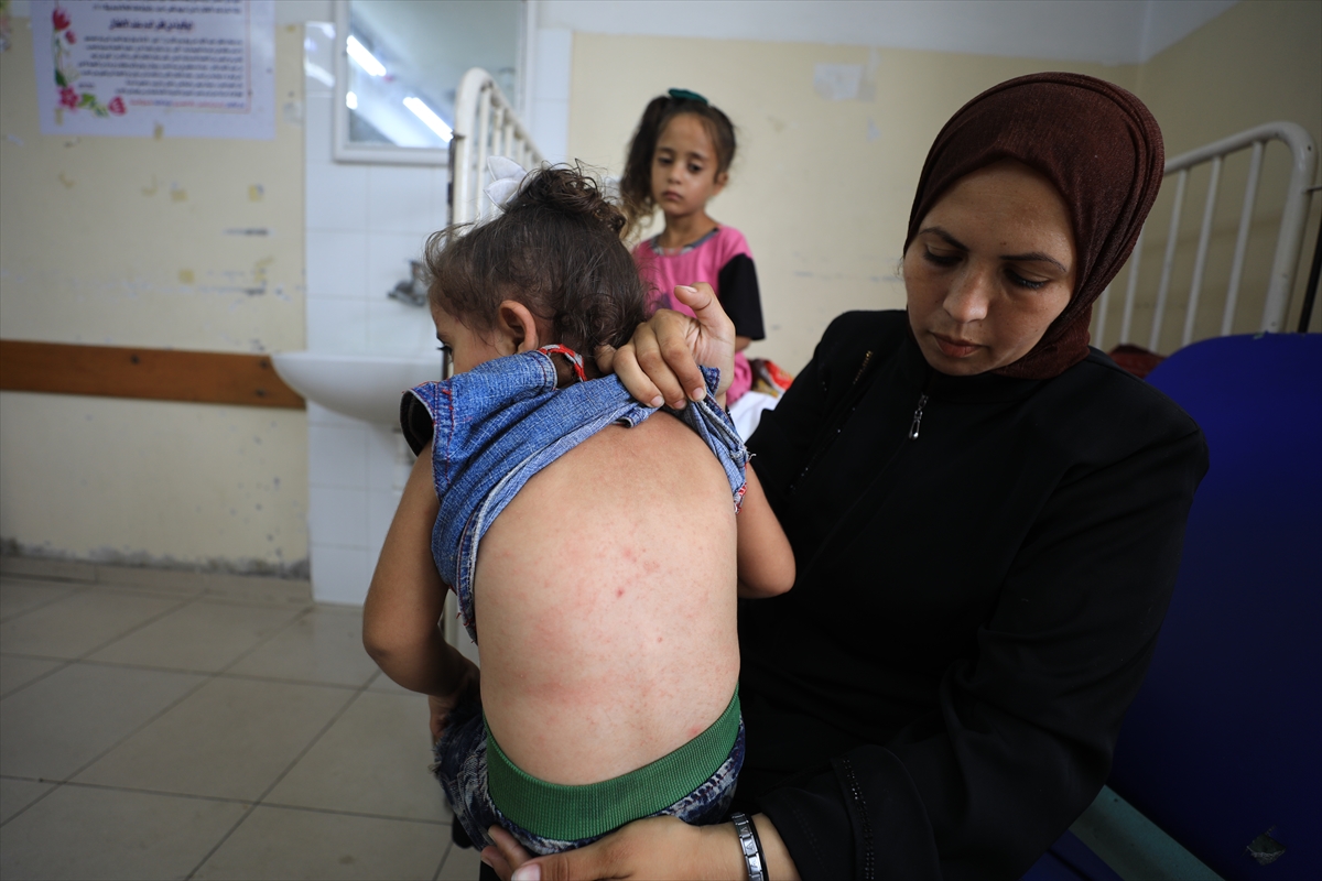 Gazze'de hijyen krizi: Çocuklarda cilt hastalıkları başladı