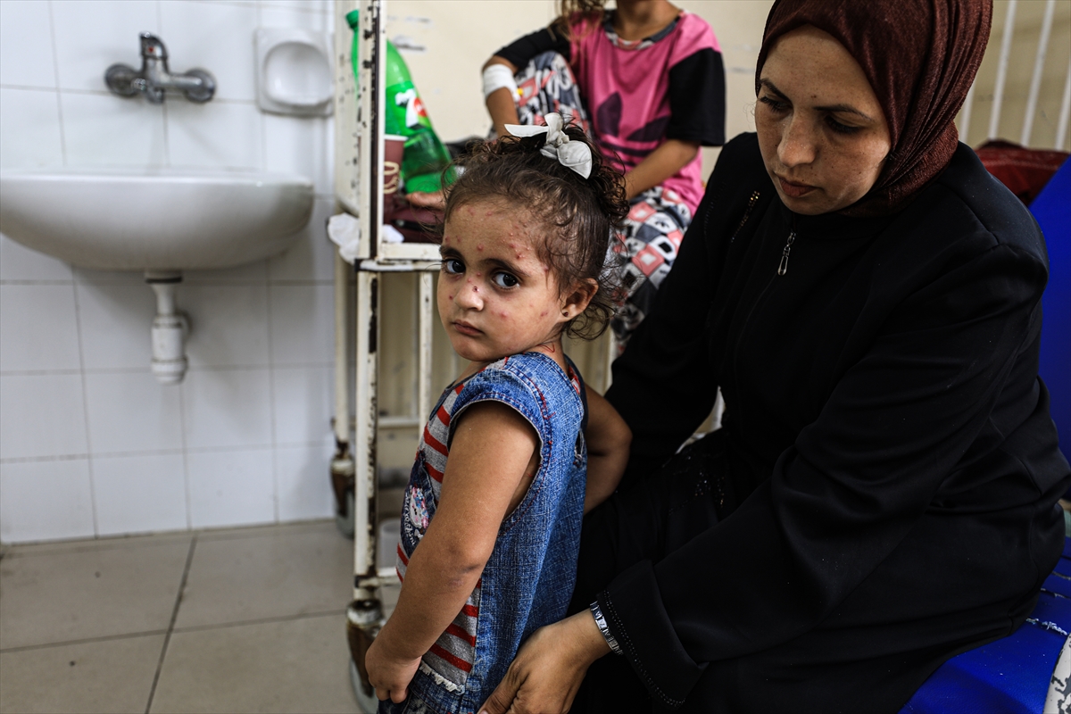 Gazze'de hijyen krizi: Çocuklarda cilt hastalıkları başladı