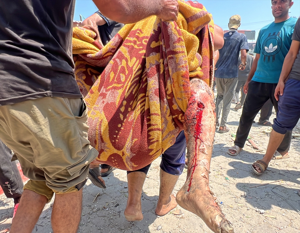 İsrail, sahra hastanesini bombaladı: 31 ölü