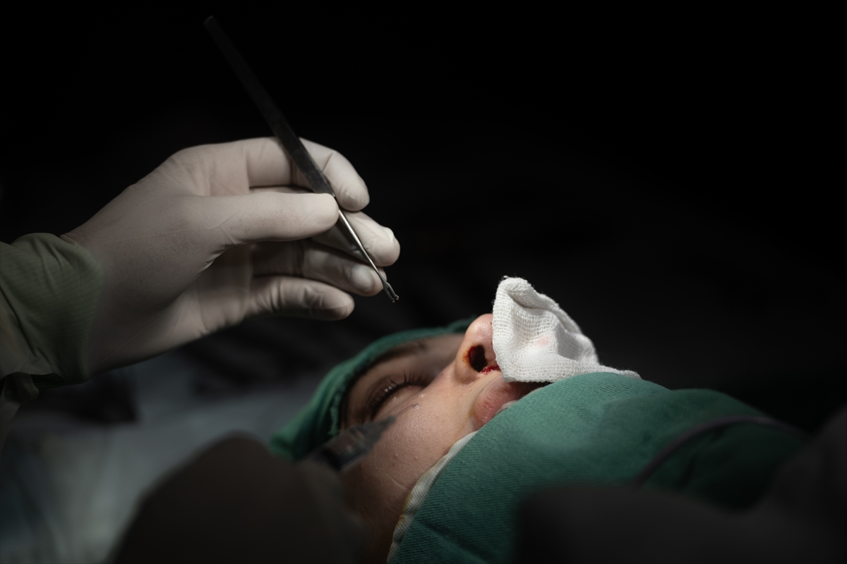 Suriye'de estetik operasyonlara ilgi artıyor