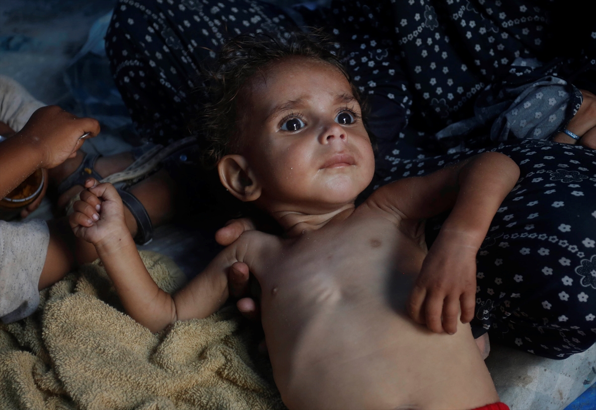 Gazze'de bebekler beslenme sıkıntısı yaşıyor