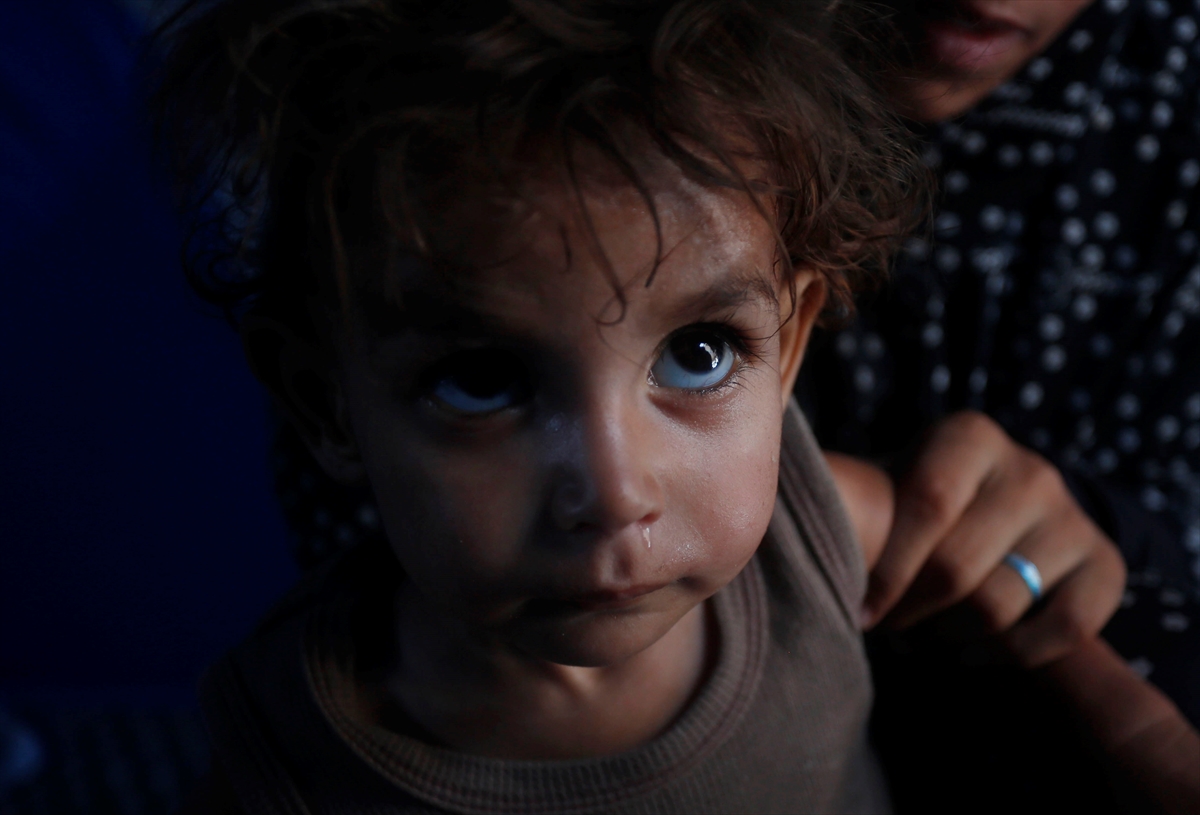 Gazze'de bebekler beslenme sıkıntısı yaşıyor