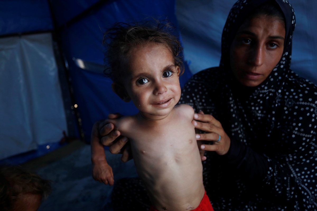 Gazze'de bebekler beslenme sıkıntısı yaşıyor