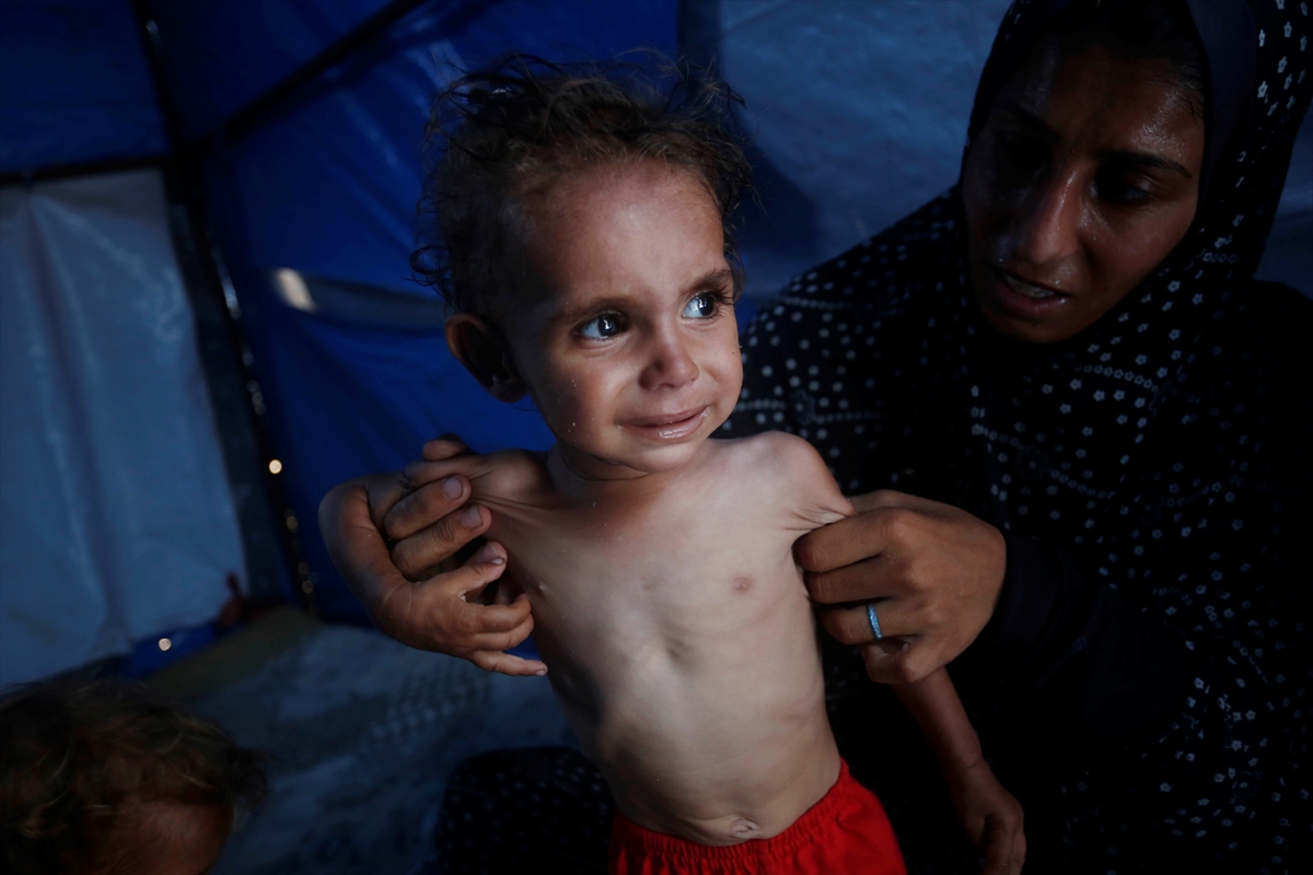 Gazze'de bebekler beslenme sıkıntısı yaşıyor