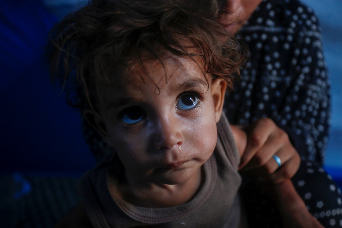 Gazze'de bebekler beslenme sıkıntısı yaşıyor