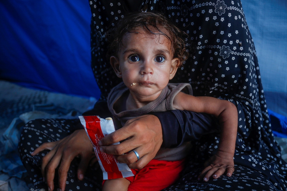 Gazze'de bebekler beslenme sıkıntısı yaşıyor